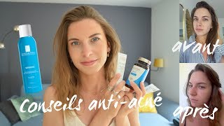 Routine amp Conseils AntiAcné sans pilule antibiotiques oraux roaccutane [upl. by Hgielyak]