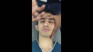 Facial palsy Rehabilitation practical [upl. by Thaddus315]