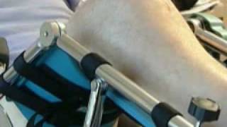 CPM for the Knee  Continuous Passive Motion Machine [upl. by Llehctim]