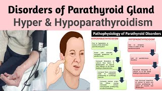 MSN 28 Disorders of Parathyroid Gland Hyper amp Hypoparathyroidism INC Syllabus [upl. by Nrubliw]