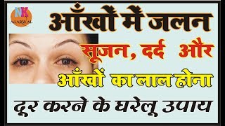 आँखों में जलन सूजन लाल होना प्रभावशाली घरेलु उपाय Burning Eye Home Remedies [upl. by Sirhc]