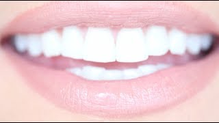 How to Get Really White Teeth For Cheap  Kandee Johnson [upl. by Cartan692]