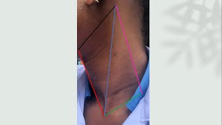 ANATOMY OF THE POSTERIOR NECK TRIANGLE [upl. by Dicks445]