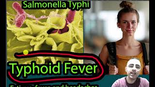 Typhoid Fever Symptoms Causes and treatment [upl. by Hamfurd813]