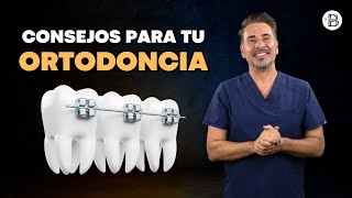 Consejos para tu ORTODONCIA con el Dr Blanco 💡🦷 [upl. by Garling]