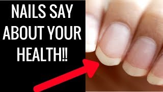 Fingernail Color Health  5 Things Your Nails Say About Your Health [upl. by Huey]