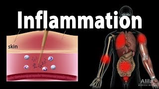 Inflammatory Response Animation [upl. by Dnalevets]