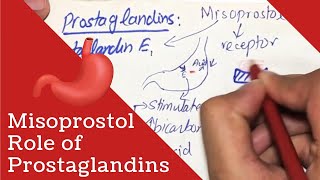 MISOPROSTOL  Role of Prostaglandins in Peptic Ulcer [upl. by Lluj]