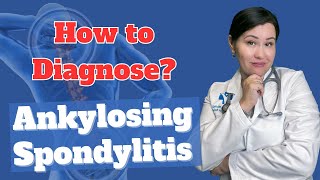 How to Diagnose Ankylosing spondylitis  Dr Diana Girnita [upl. by Juno78]