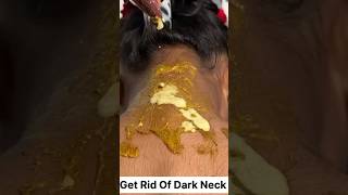 Dark Neck Removal Dark Neck Home Remedy darkneck necktanning shorts neckcleaning skincare [upl. by Uon]