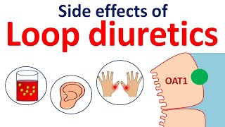 Loop diuretics side effects in easy way  Furosemide bumetanide torsemide [upl. by Gleason]