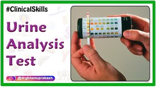 Urine analysis test procedure  Biochemistry Practicals [upl. by Neslund135]