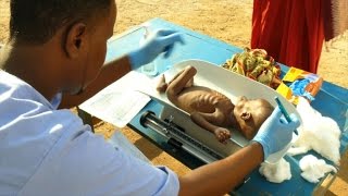 Malnutrition at record high in droughthit Somalia ICRC [upl. by Salba924]