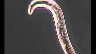 Nematodo Meloidogyne [upl. by Pliam]