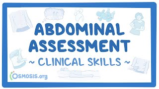 Abdominal Assessment Clinical Skills [upl. by Asilak792]