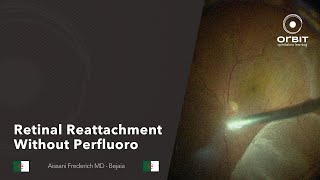 Orbit Tips 059  Retinal reattachment without perfluoro [upl. by Atalaya]