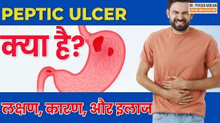 😨Peptic Ulcerपेट में अल्सर  Peptic Ulcer क्या है  Peptic Ulcer लक्षण कारण और इलाज in Hindi [upl. by Theron]