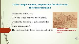 Leukocyte Esterase and Nitrite detection in urine analysis [upl. by Feld586]