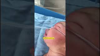 Opisthotonos posture in newborn  care of newborn baby  newborn born baby  youtubeshorts [upl. by Isabelita]