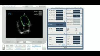 wwwmyechocardiographycom [upl. by Sherlocke]