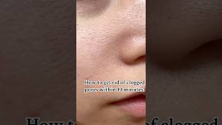 Amazon Prime Day MustHave  How To Get Rid of Pores In 10 minutes [upl. by Heall]