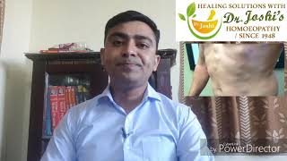 Lipoma Homeopathic Medicine For lipoma [upl. by Valery60]