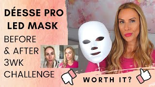 Déese Pro LED Mask  3wks Before amp After  Honest Review [upl. by Housen]