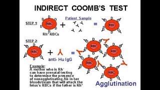 Indirect Coomb Test ICT [upl. by Eahs]