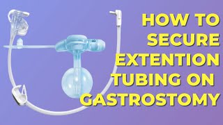 HOW TO SECURE GASTROSTOMY EXTENSION TUBING [upl. by Tehc]