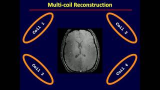 M219 2016 Lecture 17  Fast Imaging with Clinical Application Peng Hu PhD [upl. by Notsgnal68]