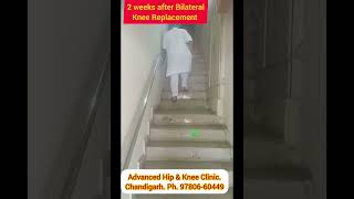 Ultra fast recovery after Bilateral Knee Replacement Surgery chandigarh [upl. by Chard]