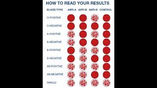 blood group all ab abooabab How to blood Grouping [upl. by Emmy]