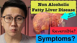 NAFLDNASH Symptoms  How to Reverse Fatty Liver Disease [upl. by Rebane]