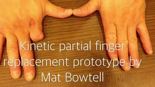 Kinetic partial finger replacement prototype by Mat Bowtell [upl. by Eiramllij]