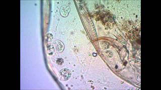 Инфузории поедают дафнию under microscope [upl. by Lienad]