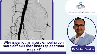 Why is genicular artery embolization more difficult than knee replacement surgery [upl. by Devitt974]