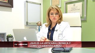 ¿Qué es la urticaria crónica [upl. by Vivica318]