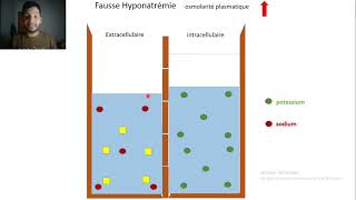 7Fausse hyponatrémie [upl. by Lange819]