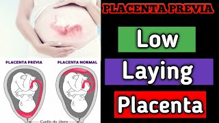 low laying placenta ka kya matlab hota hai 🙏🙏🤔 [upl. by Itsym692]