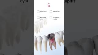 Anatomy quiz  oral pathology in 3D  Have you guessed it right anatomy 3danatomy [upl. by Burrell]