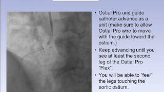 OstialPRO® Stent Positioning System RCA 2 [upl. by Hirza50]