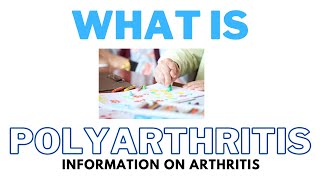 What Is Polyarthritis  The Cause The Symptoms amp The Diagnosis [upl. by Shull]