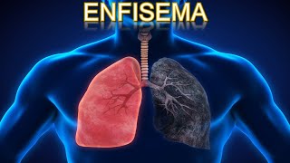 ENFISEMA  MEDICINA HUMANA  MediCiencia [upl. by Aisetal]