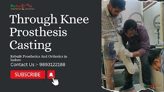 Casting of Knee Prosthesis in Rebuilt Indore  Casting  Knee Prosthesis viral video sub [upl. by Sinnoda]