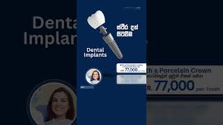 Dental implants  දත් සිටවිම  කායෝ ඩෙන්ටල්  Cayo Dental sri lanka [upl. by Keiryt]