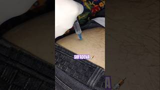 Intramuscular injection [upl. by Harriot967]