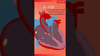 Atrial Fibrillation Sound  Heartbeat Sound and Explanation heartbeat atrialfibrillation [upl. by Atews]