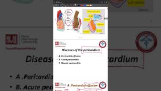 pericardial diseases and myocarditis [upl. by Ynffit746]