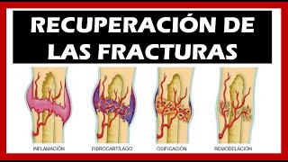 Consolidación de las Fracturas 🦴 Tiempo Fases [upl. by Floria]