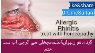 Allergic Rhinitis homeo medicine dust allergic pollen allergy tips and tricks vlogs pakistani [upl. by Akanke90]